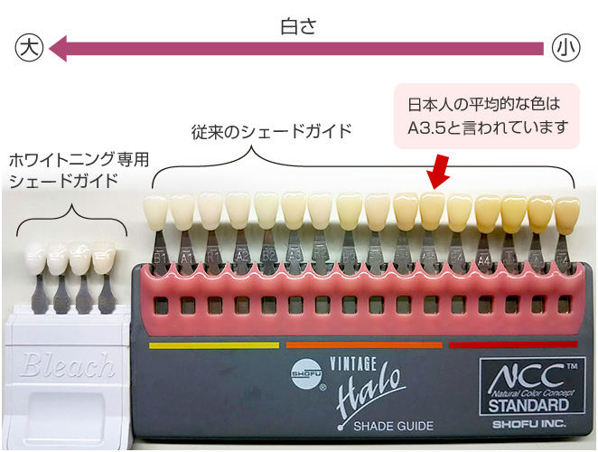 ホワイトニング