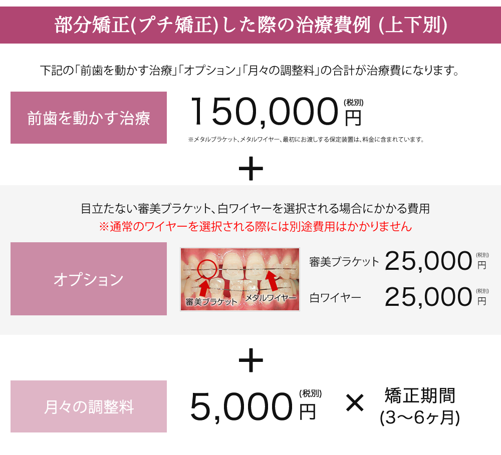 前歯の部分矯正