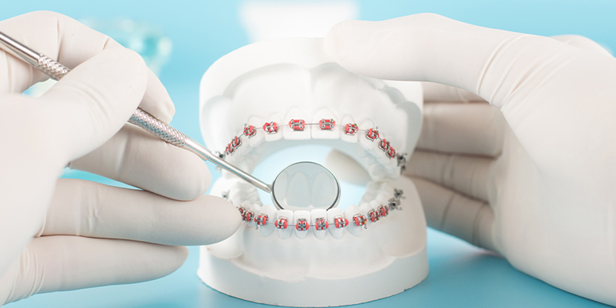 マウスピースと女性